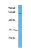 Anti-SMAD4 antibody produced in rabbit affinity isolated antibody