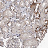 Anti-PDK1 antibody produced in rabbit Prestige Antibodies® Powered by Atlas Antibodies, affinity isolated antibody, buffered aqueous glycerol solution
