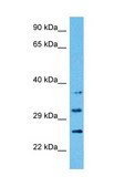 Anti-ATP1B1 antibody produced in rabbit affinity isolated antibody