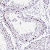 Anti-MORC4 antibody produced in rabbit Prestige Antibodies® Powered by Atlas Antibodies, affinity isolated antibody, buffered aqueous glycerol solution