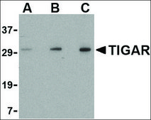 Anti-TIGAR (ab1) antibody produced in rabbit affinity isolated antibody, buffered aqueous solution