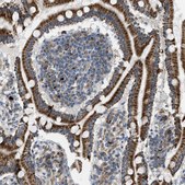 Anti-TPH1 antibody produced in rabbit Prestige Antibodies® Powered by Atlas Antibodies, affinity isolated antibody, buffered aqueous glycerol solution