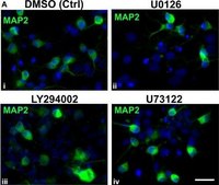 抗MAP2抗体，克隆AP20 clone AP20, Chemicon®, from mouse
