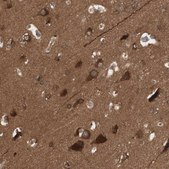 Anti-YWHAB antibody produced in rabbit Prestige Antibodies® Powered by Atlas Antibodies, affinity isolated antibody, buffered aqueous glycerol solution