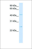 Anti-SLC37A4 antibody produced in rabbit affinity isolated antibody