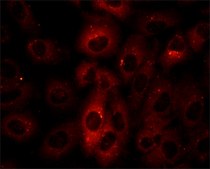 Anti-p62/SQSTM1 antibody produced in rabbit ~1 mg/mL, affinity isolated antibody, buffered aqueous solution
