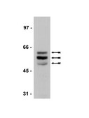 Anti-Tau (4-repeat isoform RD4) Antibody, clone 1E1/A6 culture supernatant, clone 1E1/A6, Upstate®