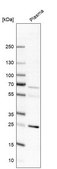 Anti-EDN1 antibody produced in rabbit Prestige Antibodies® Powered by Atlas Antibodies, affinity isolated antibody, buffered aqueous glycerol solution