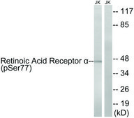 Anti-Retinoic Acid Receptor A (Phospho-SER77) affinity isolated antibody