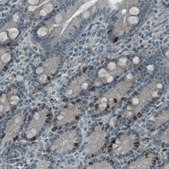 Monoclonal Anti-MKI67 antibody produced in mouse Prestige Antibodies® Powered by Atlas Antibodies, clone CL1234, purified immunoglobulin, buffered aqueous glycerol solution