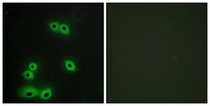 Anti-MUC1 antibody produced in rabbit affinity isolated antibody