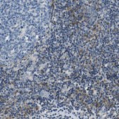 Anti-NLRP3 antibody produced in rabbit Prestige Antibodies® Powered by Atlas Antibodies, affinity isolated antibody, buffered aqueous glycerol solution