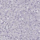抗-PRPH2 兔抗 Prestige Antibodies® Powered by Atlas Antibodies, affinity isolated antibody, buffered aqueous glycerol solution