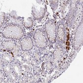 Anti-CSF3R antibody produced in rabbit Prestige Antibodies® Powered by Atlas Antibodies, affinity isolated antibody, buffered aqueous glycerol solution