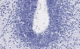 抗-LMX-1抗体，克隆4L12，ZooMAb®兔单克隆抗体 recombinant, expressed in HEK 293 cells