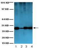 Anti-Actin Antibody, smooth muscle, clone ASM-1 clone ASM-1, Chemicon®, from mouse