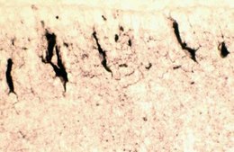 Anti-Reelin Antibody, a.a. 164-189 mreelin, clone 142 clone 142, Chemicon®, from mouse