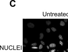 Anti-Fibronectin antibody, Mouse monoclonal clone IST-4, purified from hybridoma cell culture