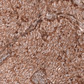 Monoclonal Anti-Igfbp2 Antibody Produced In Mouse Prestige Antibodies® Powered by Atlas Antibodies, clone CL13563, affinity isolated antibody, buffered aqueous glycerol solution