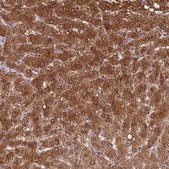 Anti-ADH1A antibody produced in rabbit Prestige Antibodies® Powered by Atlas Antibodies, affinity isolated antibody, buffered aqueous glycerol solution