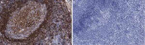 Anti-CD73 (NT5E) Antibody, clone 1F22 ZooMAb® Rabbit Monoclonal recombinant, expressed in HEK 293 cells