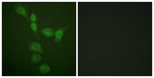 Anti-PKA α antibody produced in rabbit affinity isolated antibody