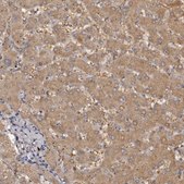 Anti-KCNJ8 antibody produced in rabbit Prestige Antibodies® Powered by Atlas Antibodies, affinity isolated antibody, buffered aqueous glycerol solution