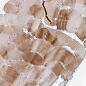 Anti-MYLK2 antibody produced in rabbit Prestige Antibodies® Powered by Atlas Antibodies, affinity isolated antibody, buffered aqueous glycerol solution