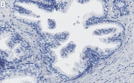 Anti-TIMP-1 Antibody, clone 1H19 ZooMAb® Rabbit Monoclonal recombinant, expressed in HEK 293 cells