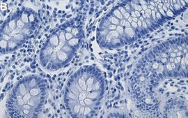 Anti-NPM/B23 Antibody, clone 2H21 ZooMAb® Rabbit Monoclonal recombinant, expressed in HEK 293 cells