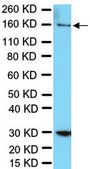 Anti-RAD50 Antibody from rabbit, purified by affinity chromatography