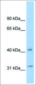 Anti-YWHAQ antibody produced in rabbit affinity isolated antibody