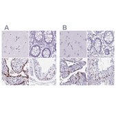 Anti-MORC4 antibody produced in rabbit Prestige Antibodies® Powered by Atlas Antibodies, affinity isolated antibody, buffered aqueous glycerol solution