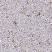 Anti-GFAP antibody produced in rabbit Prestige Antibodies® Powered by Atlas Antibodies, affinity isolated antibody, buffered aqueous glycerol solution