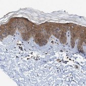 抗-TRIM65 兔抗 Prestige Antibodies® Powered by Atlas Antibodies, affinity isolated antibody, buffered aqueous glycerol solution, Ab2