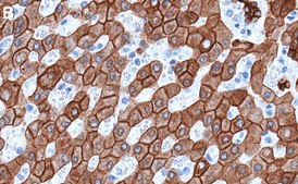 Anti-Cytokeratin 18 Antibody, clone 1G20 ZooMAb® Rabbit Monoclonal recombinant, expressed in HEK 293 cells