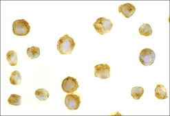 Anti-Survivin antibody produced in rabbit affinity isolated antibody, buffered aqueous solution