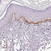 Anti-COL7A1 antibody produced in rabbit Prestige Antibodies® Powered by Atlas Antibodies, affinity isolated antibody, buffered aqueous glycerol solution