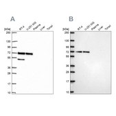 Anti-PAK4 antibody produced in rabbit Prestige Antibodies® Powered by Atlas Antibodies, affinity isolated antibody