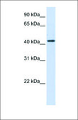 Anti-HSD3B2 affinity isolated antibody