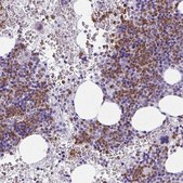 Anti-CDA antibody produced in rabbit Prestige Antibodies® Powered by Atlas Antibodies, affinity isolated antibody, buffered aqueous glycerol solution