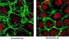 抗磷酸化-Akt（Ser473）抗体，克隆6F5 clone 6F5, from mouse