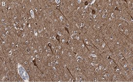 Anti-Neurofilament H Antibody, clone 5L10, ZooMAb® Rabbit Monoclonal recombinant, expressed in HEK 293 cells