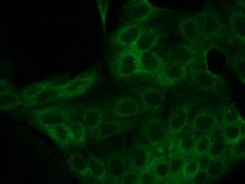 Anti-Calreticulin antibody produced in rabbit IgG fraction of antiserum, buffered aqueous solution