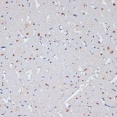 Anti-PARP1 antibody produced in rabbit