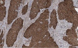 Anti-Integrin β1 Antibody, clone 1A27 , ZooMAb® Rabbit Monoclonal recombinant, expressed in HEK 293 cells