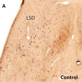 单克隆抗酪氨酸羟化酶 小鼠抗 clone TH-16, ascites fluid