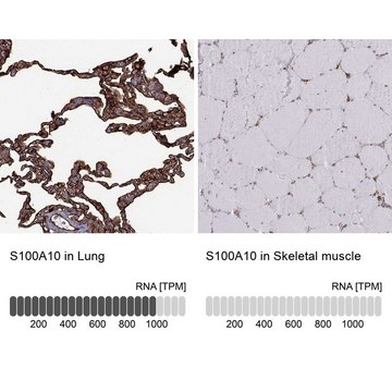 Anti-S100A10 antibody produced in rabbit Prestige Antibodies® Powered by Atlas Antibodies, affinity isolated antibody, buffered aqueous glycerol solution