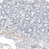 Monoclonal Anti-B3GAT1 antibody produced in mouse Prestige Antibodies® Powered by Atlas Antibodies, clone CL9500, purified immunoglobulin, buffered aqueous glycerol solution