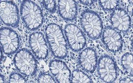 Anti-Rictor Antibody, clone 1K9 ZooMAb® Rabbit Monoclonal recombinant, expressed in HEK 293 cells